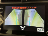 サイドモニターがあれば、見えにくい側方下部も確認可能できます。