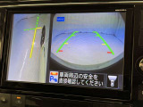 サイドモニターがあれば、見えにくい側方下部も確認可能できます。