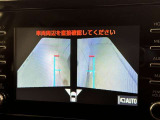 サイドモニターがあれば、見えにくい側方下部も確認可能できます。