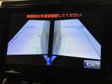 サイドモニターがあれば、見えにくい側方下部も確認可能できます。