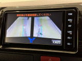 サイドモニターがあれば、見えにくい側方下部も確認可能できます。