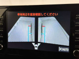 サイドモニターがあれば、見えにくい側方下部も確認可能できます。