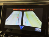 サイドモニターがあれば、見えにくい側方下部も確認可能できます。