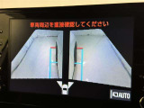 サイドモニターがあれば、見えにくい側方下部も確認可能できます。