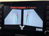 サイドモニターがあれば、見えにくい側方下部も確認可能できます。