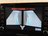 サイドモニターがあれば、見えにくい側方下部も確認可能できます。