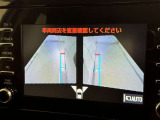サイドモニターがあれば、見えにくい側方下部も確認可能できます。
