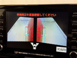 サイドモニターがあれば、見えにくい側方下部も確認可能できます。