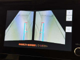 サイドモニターがあれば、見えにくい側方下部も確認可能できます。