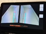 サイドモニターがあれば、見えにくい側方下部も確認可能できます。
