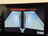 サイドモニターがあれば、見えにくい側方下部も確認可能できます。