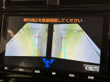 サイドモニターがあれば、見えにくい側方下部も確認可能できます。